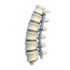Spine